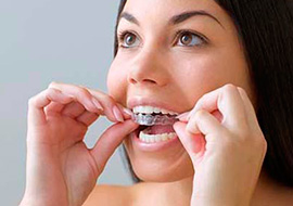 Ортодонтия в стоматологической клинике SmileHouse