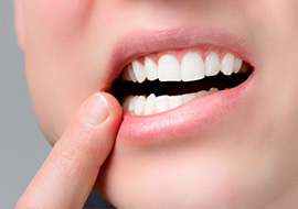 Парадонтия в стоматологической клинике SmileHouse